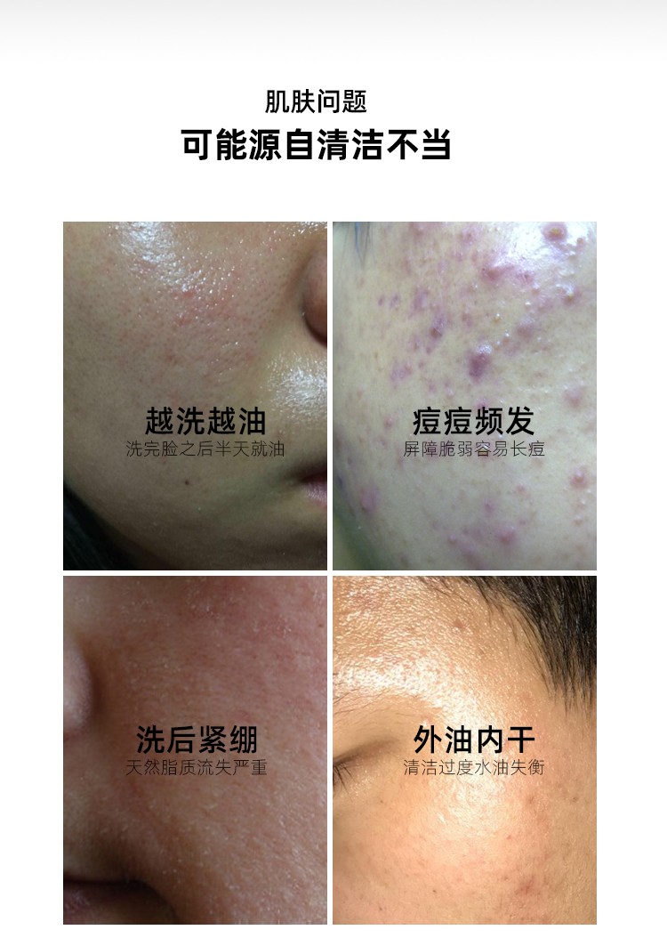 人仁和匠心植物复合净颜洁面乳 控油净痘除螨洗面奶