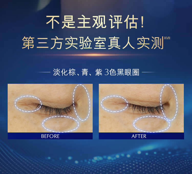 雅诗兰黛特润修护肌活精华眼霜 细胞级眼周抗疲劳衰老淡鱼尾纹第5代小综瓶眼霜