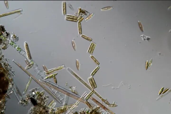 是焕肤神器还是毁肤杀手？深扒海绵微针！