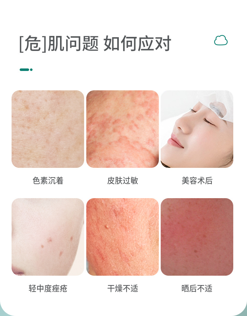 械字号医用透明质酸钠修复液工厂 晒后修护熬夜维稳玻尿酸精华液痤疮抑菌创面愈合喷雾代加工厂家